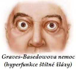 Basedowova nemoc, zvýšená funkce štítné žlázy - byliny, bylinky, babské rady